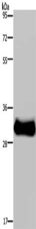 Gel: 8%SDS-PAGE, Lysate: 40 μg, Lane: Mouse skeletal muscle tissue, Primary antibody: FHL3 Antibody(FHL3 Antibody) at dilution 1/1600, Secondary antibody: Goat anti rabbit IgG at 1/8000 dilution, Exposure time: 30 secondsRabbit anti-Human FHL3 Polyclonal Antibody