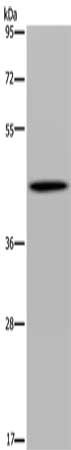 Gel: 8%SDS-PAGE, Lysate: 40 μg, Lane: Human fetal brain tissue, Primary antibody: FADS1 Antibody(FADS1 Antibody) at dilution 1/300, Secondary antibody: Goat anti rabbit IgG at 1/8000 dilution, Exposure time: 2 minutesRabbit anti-Human FADS1 Polyclonal Antibody