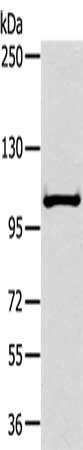 Gel: 6%SDS-PAGE, Lysate: 40 μg, Lane: Mouse liver tissue, Primary antibody: NPR2 Antibody(NPR2 Antibody) at dilution 1/300, Secondary antibody: Goat anti rabbit IgG at 1/8000 dilution, Exposure time: 30 secondsRabbit anti-Human NPR2 Polyclonal Antibody