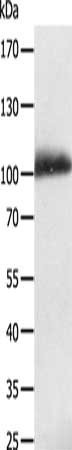 Gel: 8%SDS-PAGE, Lysate: 40 μg, Lane: Human liver cancer tissue, Primary antibody: LRP12 Antibody(LRP12 Antibody) at dilution 1/200, Secondary antibody: Goat anti rabbit IgG at 1/8000 dilution, Exposure time: 10 minutes