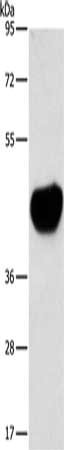 Gel: 8%SDS-PAGE, Lysate: 40 μg, Lane: Mouse heart tissue, Primary antibody: ACTA2 Antibody(ACTA2 Antibody) at dilution 1/800, Secondary antibody: Goat anti rabbit IgG at 1/8000 dilution, Exposure time: 1 minute