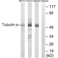 Western blot analysis of extracts from MCF7,COLO and  HepG2 cells, using Tubulin α antibody.Rabbit anti-Human TUBA1A Polyclonal Antibody