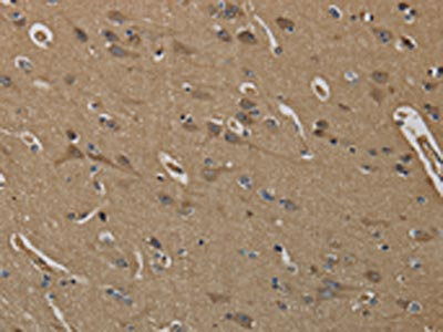 The image on the left is immunohistochemistry of paraffin-embedded Human brain  tissue using KLK6 Antibody(KLK6 Antibody) at dilution 1/60, on the right is treated with fusion protein. (Original magnification: ×200)