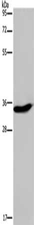 Gel: 10%SDS-PAGE, Lysate: 40 μg, Lane: A375 cells, Primary antibody: KLK6 Antibody(KLK6 Antibody) at dilution 1/300, Secondary antibody: Goat anti rabbit IgG at 1/8000 dilution, Exposure time: 1 minute