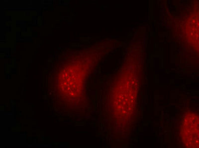 Immunofluorescence staining of methanol-fixed Hela cells using p90RSK(Phospho-Thr348) Antibody.Rabbit anti-Human RPS6KA1 Polyclonal Antibody