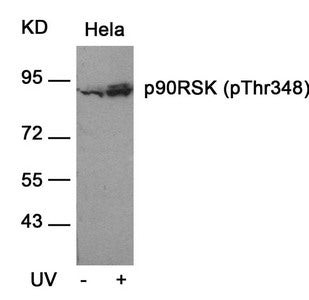 Western blot analysis of extracts from Hela cells untreated or treated with UV using p90RSK(Phospho-Thr348) Antibody.Rabbit anti-Human RPS6KA1 Polyclonal Antibody