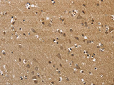 The image on the left is immunohistochemistry of paraffin-embedded Human brain tissue using the antibody Antibody) at dilution 1/40, on the right is treated with synthetic peptide. (Original magnification: ×200)