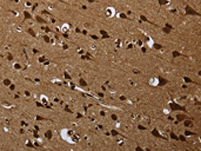 The image on the left is immunohistochemistry of paraffin-embedded Human brain  tissue using ANP32E Antibody(ANP32E Antibody) at dilution 1/25, on the right is treated with synthetic peptide. (Original magnification: ×200)Rabbit anti-Human ANP32E Polyclonal Antibody