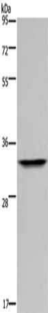 Gel: 10%SDS-PAGE, Lysate: 40 μg, Lane: Mouse thymus tissue, Primary antibody: ANP32E Antibody(ANP32E Antibody) at dilution 1/300, Secondary antibody: Goat anti rabbit IgG at 1/8000 dilution, Exposure time: 20 secondsRabbit anti-Human ANP32E Polyclonal Antibody