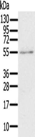 Gel: 6%SDS-PAGE, Lysate: 40 μg, Lane: A172 cells, Primary antibody: RORB Antibody(RORB Antibody) at dilution 1/200, Secondary antibody: Goat anti rabbit IgG at 1/8000 dilution, Exposure time: 1 minuteRabbit anti-Human RORB Polyclonal Antibody
