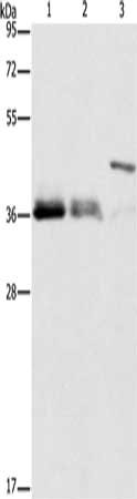 Gel: 10%SDS-PAGE, Lysate: 40 μg, Lane 1-3: K562 cells, 231 cells, SKOV3 cells, Primary antibody: TNFSF13B Antibody(TNFSF13B Antibody) at dilution 1/200, Secondary antibody: Goat anti rabbit IgG at 1/8000 dilution, Exposure time: 10 secondsRabbit anti-Human TNFSF13B Polyclonal Antibody