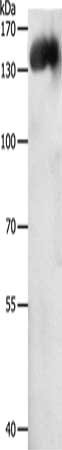 Gel: 8%SDS-PAGE, Lysate: 60 μg, Lane: Jurkat cells, Primary antibody: PECAM1 Antibody(PECAM1 Antibody) at dilution 1/500, Secondary antibody: Goat anti rabbit IgG at 1/8000 dilution, Exposure time: 5 minutesRabbit anti-Human PECAM1 Polyclonal Antibody