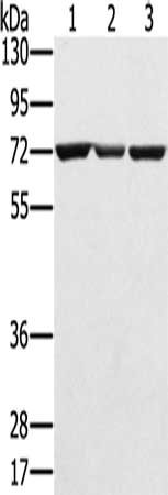Gel: 8%SDS-PAGE, Lysate: 40 μg, Lane 1-3: Hepg2 cells, A172 cells, Raji cells, Primary antibody: SLC25A13 Antibody(SLC25A13 Antibody) at dilution 1/450, Secondary antibody: Goat anti rabbit IgG at 1/8000 dilution, Exposure time: 1 minuteRabbit anti-Human SLC25A13 Polyclonal Antibody