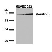 Western blot analysis of extracts from HUVEC and 293 cells using Keratin 8(Ab-74) Antibody.