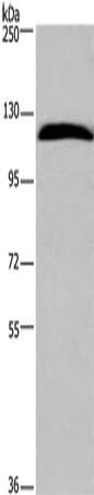 Gel: 6%SDS-PAGE, Lysate: 40 μg, Lane: Hela cells, Primary antibody: IPO7 Antibody(IPO7 Antibody) at dilution 1/300, Secondary antibody: Goat anti rabbit IgG at 1/8000 dilution, Exposure time: 3 minutes