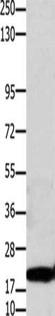 Gel: 10%SDS-PAGE, Lysate: 30μg, Lane: Hela cells, Primary antibody: CLDN1 Antibody(CLDN1 Antibody) at dilution 1/1100, Secondary antibody: Goat anti rabbit IgG at 1/8000 dilution, Exposure time: 40 secondsRabbit anti-Human CLDN1 Polyclonal Antibody