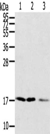 Gel: 12%SDS-PAGE, Lysate: 40 μg, Lane 1-3: A549 cells, lovo cells, hela cells, Primary antibody: SNX3 Antibody(SNX3 Antibody) at dilution 1/250, Secondary antibody: Goat anti rabbit IgG at 1/8000 dilution, Exposure time: 2 minutesRabbit anti-Human SNX3 Polyclonal Antibody
