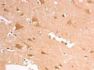 The image on the left is immunohistochemistry of paraffin-embedded Human brain tissue using AASDHPPT Antibody(AASDHPPT Antibody) at dilution 1/30, on the right is treated with fusion protein. (Original magnification: ×200)