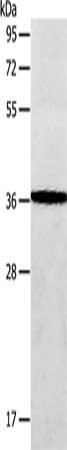 Gel: 10%SDS-PAGE, Lysate: 40 μg, Lane: Human fetal brain tissue, Primary antibody: AASDHPPT Antibody(AASDHPPT Antibody) at dilution 1/650, Secondary antibody: Goat anti rabbit IgG at 1/8000 dilution, Exposure time: 30 seconds