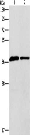 Gel: 10%SDS-PAGE, Lysate: 40 μg, Lane 1-2: Human fetal liver tissue, huvec cells, Primary antibody: APOL2 Antibody(APOL2 Antibody) at dilution 1/725, Secondary antibody: Goat anti rabbit IgG at 1/8000 dilution, Exposure time: 40 secondsRabbit anti-Human APOL2 Polyclonal Antibody