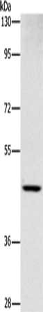 Gel: 8%SDS-PAGE, Lysate: 40 μg, Lane: Human placenta tissue, Primary antibody: SIGLEC6 Antibody(SIGLEC6 Antibody) at dilution 1/1000, Secondary antibody: Goat anti rabbit IgG at 1/8000 dilution, Exposure time: 1 minute