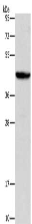 Gel: 10%SDS-PAGE, Lysate: 40 μg, Lane: Mouse liver tissue, Primary antibody: ORM2 Antibody(ORM2 Antibody) at dilution 1/700, Secondary antibody: Goat anti rabbit IgG at 1/8000 dilution, Exposure time: 10 secondsRabbit anti-Human ORM2 Polyclonal Antibody