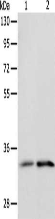 Gel: 10%SDS-PAGE, Lysate: 40 μg, Lane 1-2: Human fetal kidney tissue, Human intestine tissue, Primary antibody: IL1RL1 Antibody(IL1RL1 Antibody) at dilution 1/1100, Secondary antibody: Goat anti rabbit IgG at 1/8000 dilution, Exposure time: 2 minutes