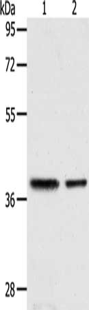 Gel: 10%SDS-PAGE, Lysate: 40 μg, Lane 1-2: Human fetal kidney tissue, Human fetal muscle tissue, Primary antibody: CNN3 Antibody(CNN3 Antibody) at dilution 1/400, Secondary antibody: Goat anti rabbit IgG at 1/8000 dilution, Exposure time: 1 minuteRabbit anti-Human CNN3 Polyclonal Antibody