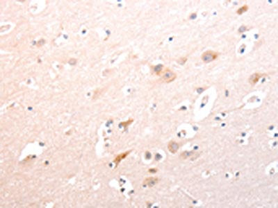 The image on the left is immunohistochemistry of paraffin-embedded Human brain tissue using TRAF3IP1 Antibody(TRAF3IP1 Antibody) at dilution 1/70, on the right is treated with fusion protein. (Original magnification: ×200)Rabbit anti-Human TRAF3IP1 Polyclonal Antibody