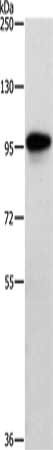 Gel: 8%SDS-PAGE, Lysate: 40 μg, Lane: Human brain malignant glioma tissue, Primary antibody: TRAF3IP1 Antibody(TRAF3IP1 Antibody) at dilution 1/500, Secondary antibody: Goat anti rabbit IgG at 1/8000 dilution, Exposure time: 2 minutesRabbit anti-Human TRAF3IP1 Polyclonal Antibody