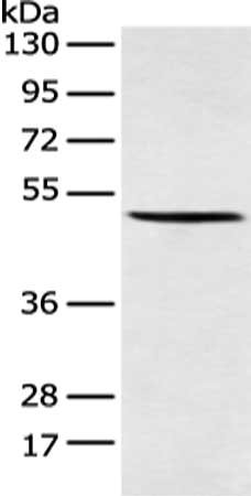 Gel: 8%SDS-PAGE, Lysate: 40 μg, Lane: Mouse adrenal gland tissue, Primary antibody: AMDHD2 Antibody(AMDHD2 Antibody) at dilution 1/250 dilution, Secondary antibody: Goat anti rabbit IgG at 1/8000 dilution, Exposure time: 20 secondsRabbit anti-Human AMDHD2 Polyclonal Antibody
