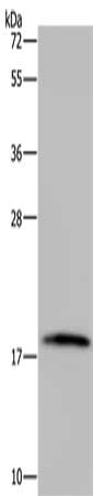 Gel: 10%SDS-PAGE, Lysate: 40 μg, Lane: Mouse thymus tissue, Primary antibody: TNFRSF13C Antibody(TNFRSF13C Antibody) at dilution 1/300, Secondary antibody: Goat anti rabbit IgG at 1/8000 dilution, Exposure time: 2 minutesRabbit anti-Human TNFRSF13C Polyclonal Antibody