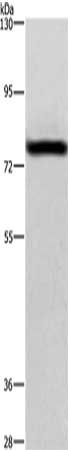 Gel: 10%SDS-PAGE, Lysate: 40 μg, Lane: Hela cell, Primary antibody: BAP1 Antibody(BAP1 Antibody) at dilution 1/375, Secondary antibody: Goat anti rabbit IgG at 1/8000 dilution, Exposure time: 30 seconds