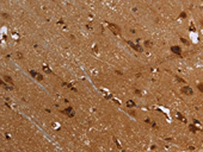 The image on the left is immunohistochemistry of paraffin-embedded Human brain  tissue using FLNA Antibody(FLNA Antibody) at dilution 1/40, on the right is treated with fusion protein. (Original magnification: ×200)
