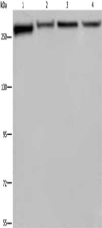 Gel: 6%SDS-PAGE, Lysate: 40 μg, Lane 1-4: PC3 cells, Hela cells, NIH/3T3 cells, HUVEC cells, Primary antibody: FLNA Antibody(FLNA Antibody) at dilution 1/800, Secondary antibody: Goat anti rabbit IgG at 1/8000 dilution, Exposure time: 1 minute