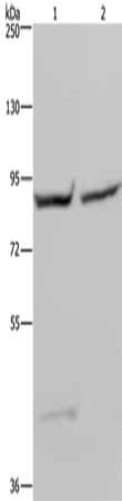 Gel: 6%SDS-PAGE, Lysate: 40 μg, Lane 1-2: 293T cells, Hela cells, Primary antibody: GYS1 Antibody(GYS1 Antibody) at dilution 1/400, Secondary antibody: Goat anti rabbit IgG at 1/8000 dilution, Exposure time: 20 secondsRabbit anti-Human GYS1 Polyclonal Antibody