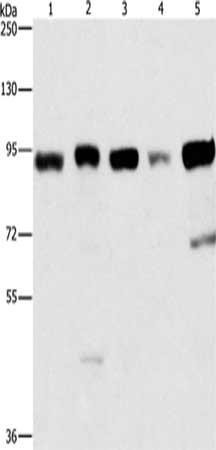 Gel: 6%SDS-PAGE,Lysate: 40 μg,Lane 1-5: Raji cells, 231 cells, HepG2 cells, Hela cells, 293T cells,Primary antibody: IMMT Antibody(IMMT Antibody) at dilution 1/270 dilution,Secondary antibody: Goat anti rabbit IgG at 1/8000 dilution,Exposure time: 5 secondsRabbit anti-Human IMMT Polyclonal Antibody