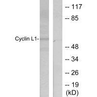 Western blot analysis of extracts from HepG2 cells, using Cyclin-L1 antibody.Rabbit anti-Human CCNL1 Polyclonal Antibody
