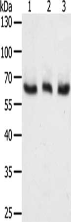 Gel: 10%SDS-PAGE, Lysate: 50 μg, Lane 1-3: A375 cells, Hela cells, Jurkat cells, Primary antibody: TYR Antibody(TYR Antibody) at dilution 1/400, Secondary antibody: Goat anti rabbit IgG at 1/8000 dilution, Exposure time: 3 minutesRabbit anti-Human TYR Polyclonal Antibody