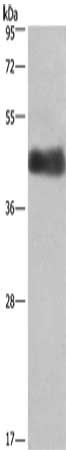 Gel: 8%SDS-PAGE, Lysate: 40 μg, Lane: Human placenta tissue, Primary antibody: CALU Antibody(CALU Antibody) at dilution 1/400, Secondary antibody: Goat anti rabbit IgG at 1/8000 dilution, Exposure time: 1 minute