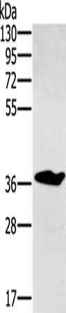 Gel: 8%SDS-PAGE, Lysate: 40 μg, Lane: Mouse liver tissue, Primary antibody: NOV Antibody(NOV Antibody) at dilution 1/300, Secondary antibody: Goat anti rabbit IgG at 1/8000 dilution, Exposure time: 3 minutesRabbit anti-Human NOV Polyclonal Antibody