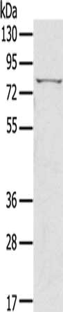 Gel: 6%SDS-PAGE, Lysate: 50 μg, Lane: Raji cells, Primary antibody: IKBKE Antibody(IKBKE Antibody) at dilution 1/400, Secondary antibody: Goat anti rabbit IgG at 1/8000 dilution, Exposure time: 30 seconds