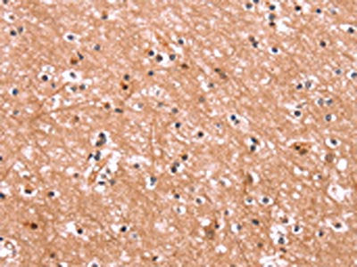 The image on the left is immunohistochemistry of paraffin-embedded Human brain tissue using the antibody Antibody) at dilution 1/15, on the right is treated with synthetic peptide. (Original magnification: ×200)Rabbit anti-Human ENPP4 Polyclonal Antibody