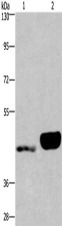 Gel: 6%SDS-PAGE, Lysate: 40 μg, Lane 1-2: Human endometrial cancer tissue, Human placenta tissue, Primary antibody: ENPP4 Antibody(ENPP4 Antibody) at dilution 1/200, Secondary antibody: Goat anti rabbit IgG at 1/8000 dilution, Exposure time: 40 secondsRabbit anti-Human ENPP4 Polyclonal Antibody