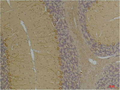 Immunohistochemical analysis of paraffin-embedded Rat BrainTissue using Kv1.8 Rabbit pAb diluted at 1:200.