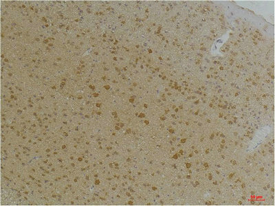 Immunohistochemical analysis of paraffin-embedded Mouse BrainTissue using Kv1.8 Rabbit pAb diluted at 1:200.