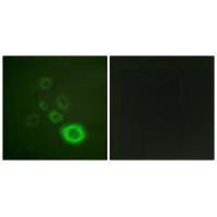 Immunofluorescence analysis of A549 cells, using c-Met (Ab-1003) antibody.Rabbit anti-Human MET Polyclonal Antibody
