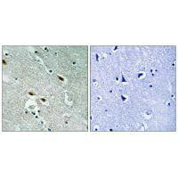 Immunohistochemistry analysis of paraffin-embedded human brain tissue using c-Met (Ab-1003) antiobdy.Rabbit anti-Human MET Polyclonal Antibody