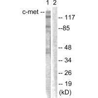 Western blot analysis of extracts from HepG2 cells, using c-Met (Ab-1003) antibody.