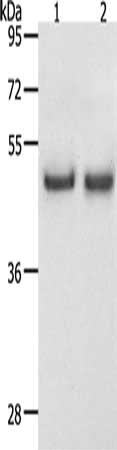 Gel: 12%SDS-PAGE, Lysate: 40 μg, Lane 1-2: Hela cells, K562 cells, Primary antibody: SPAG4 Antibody(SPAG4 Antibody) at dilution 1/1100, Secondary antibody: Goat anti rabbit IgG at 1/8000 dilution, Exposure time: 30 secondsRabbit anti-Human SPAG4 Polyclonal Antibody